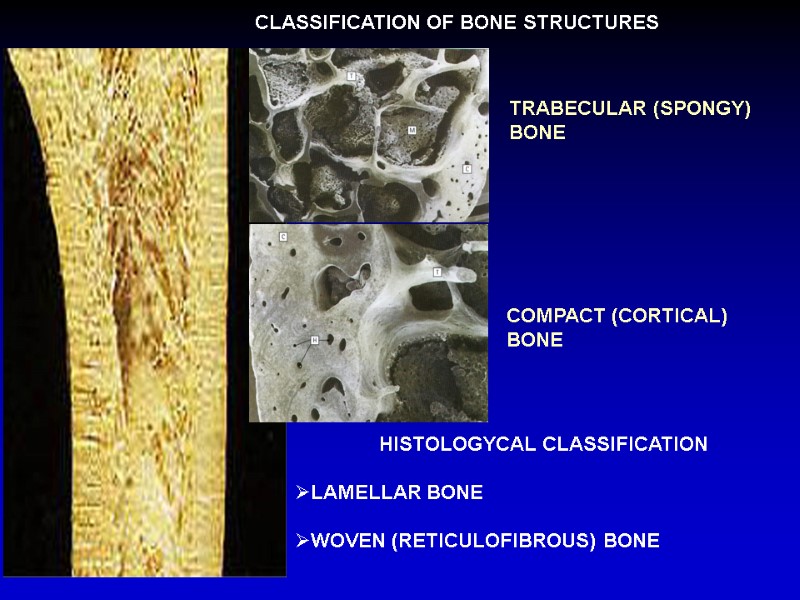 CLASSIFICATION OF BONE STRUCTURES TRABECULAR (SPONGY) BONE COMPACT (CORTICAL)  BONE HISTOLOGYCAL CLASSIFICATION 